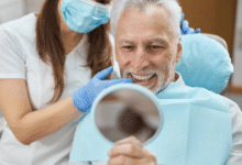 Dental Veneers: What to Expect Before You Commit